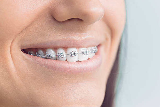Full Mouth Reconstruction in Cody, WY